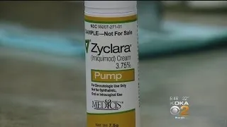 Doctors Turn To Topical Cream To Treat Common Skin Cancer