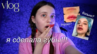 vlog: я сделала губы!!