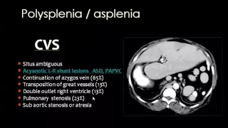 Splenic imaging   Prof Dr  Mamdouh Mahfouz In Arabic 720p