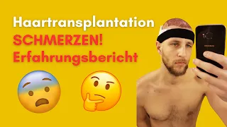 Haartransplantation Schmerzen Erfahrungsbericht - so schlimm ist es