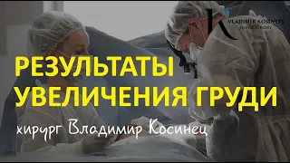 Результаты увеличения груди - хирург Владимир Косинец