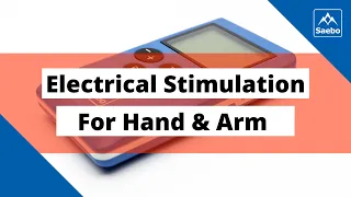 Using Electrical Stimulation for Arm and Hand Following Stroke