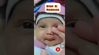 How to cure sticky eyes of babies