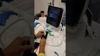 Ultrasound Guided IV Placement -- Your Design Medical