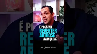 Artrose avança tem solução? Veja no vídeo. Curta e compartilhe com seus amigos e familiares.