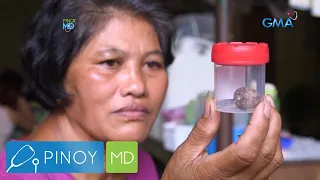 Pinoy MD: Gallstone, paano maiiwasan?