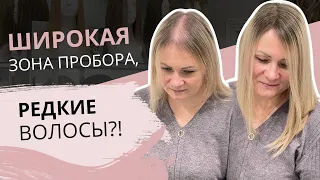 И СНОВА О РЕДКИХ ТОНКИХ ВОЛОСАХ..