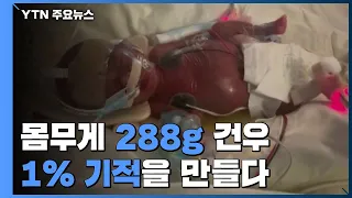 몸무게 288g 초미숙아 건우, '1%의 기적'을 만들다 / YTN