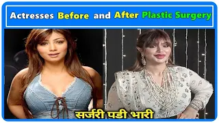 Plastic Surgery से पहले और बाद की बॉलीवुड अभिनेत्रियाँ | Actresses Before and After Plastic Surgery