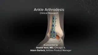 Ankle Arthrodesis: Clinical Research