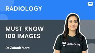 100 Radiology Images in order of importance - Part 1 | Dr Zainab Vora