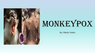 Monkeypox outbreak | all you have to know about it | transmission, symptoms, treatment, prevention