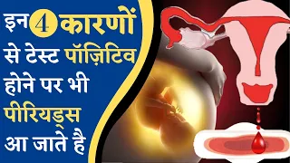 इन 4 कारणों से टेस्ट पॉजिटिव होने पर भी पीरियड्स आ सकते है || Periods after positive pregnancy test?