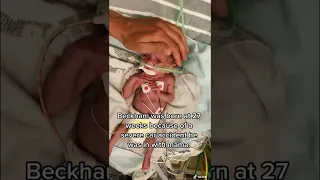 NICU WARRIOR BORN AT 27 WEEKS