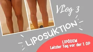 Vlog 3 - LIPÖDEM LIPOSUKTION - Letzter Tag VOR der 1.OP