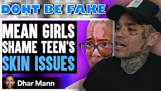 Dhar Mann - MEAN GIRLS Shame TEEN'S SKIN ISSUES, What Happens Next Is Shocking [reaction]