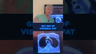 Dr. Sean O’Mara shares his on Eliminating Visceral Fat: Key to Optimal Health on a Carnivore Diet