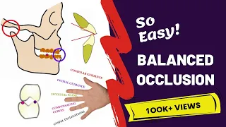 Balanced Occlusion Made Easy | PROSTHODONTICS