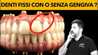 Dr Palmas: denti fissi con o senza gengiva ?