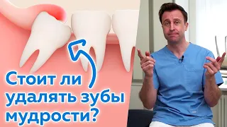 Нужно ли удалять зубы мудрости? / Где расположены зубы мудрости?