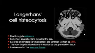 Imaging of Petrous bones II   DRE 2   Dr Mamdouh Mahfouz