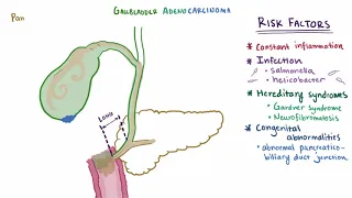 Gallbladder cancer adenocarcinoma   causes, symptoms & pathology