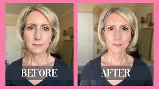 How to Get Rid of Neck Lines & Jowls Without Surgery or Fillers