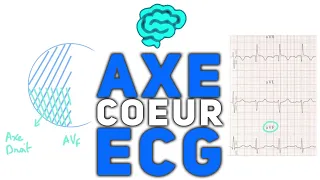 🔴 L' Axe du Coeur ECG Expliqué Très Clairement par Dr Astuce