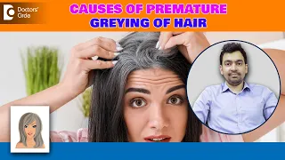 MOST Common Causes of Premature Greying of Hair |Reverse Grey Hair-Dr.Rajdeep Mysore|Doctors' Circle