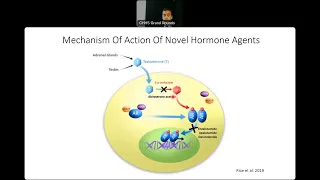 'Treatment landscape for metastatic hormone-sensitive prostate cancer' - Dr Laeeq Malik Grand Rounds