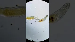 Worm Eats Single Celled Organism Under Microscope