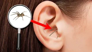 10 People Who Had Creatures Living In Their Ears 2019