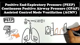 Mechanical Ventilator (Lung Mechanics: PEEP, CPAP, ACMV)