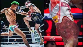 This is Going to Hurt... Deadliest Low-Kick KO's in Combat Sport - Ultimate Edition