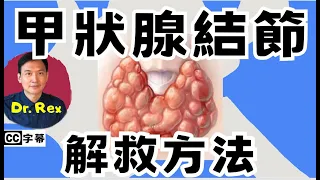 如何改善甲狀腺結節？ 什麼病徵顯示甲狀腺結節是腫瘤？