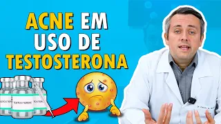 Acne Em Uso De Testosterona | Dr. Claudio Guimarães