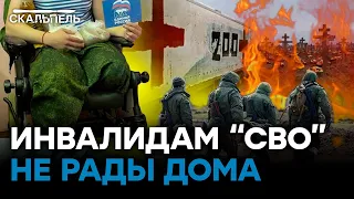 Выжившим "ГЕРОЯМ СВО" нет места в России — больничные  койки ПЕРЕПОЛНЕНЫ | Скальпель