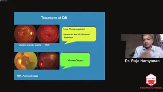 Webinar 2.T5. An overview of diabetic retinopathy and when to refer? Dr.Raja Narayanan