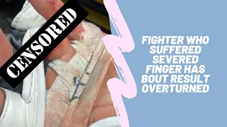 Fighter who suffered severed finger has bout result overturned