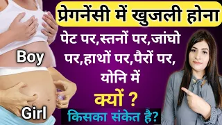 प्रेगनेंसी में खुजली क्यों होती है l Itching During Pregnancy l Symptoms Of Baby Boy Or Girl