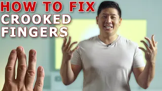 Straighten Your Crooked Fingers With This Simple Trick! | Finger Mobilization By Physical Therapist