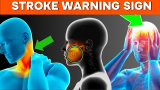 Stay Prepared: Detect it Quickly - 7 Stroke Symptoms Revealed