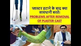 Problems after Plaster Removal| Paiin, Swelling after Cast| प्लास्टर हटाने के बाद क्या सावधानी बरतें