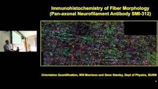 Douglas Rosene -  Neuroanatomical and Cellular Correlates of Diffusion MR Tractography