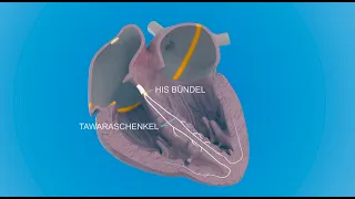 Das elektrische Reizleitungssystem in unserem Herzen