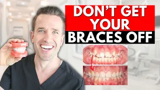 Braces Off! How to know if you're DONE WITH BRACES?!