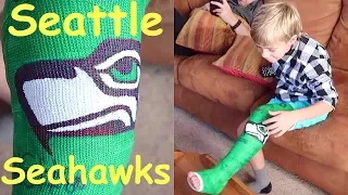 🏈Kid gets a SEATTLE SEAHAWKS Cast for Broken Leg!🏈