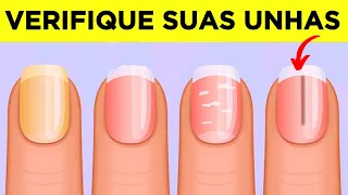 9 coisas Surpreendentes que suas UNHAS podem Dizer sobre sua Saúde