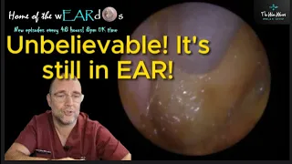 Unbelievable! It's still in EAR! 202 #ear #earwax #earwaxremoval #earcleaning #asmr #fyp #satisfying