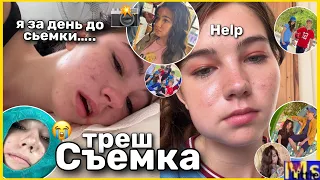 САМЫЙ УЖАСНЫЙ ДЕНЬ *треш съемка* || вырвали зуб мудрости за день до съемки😭 это капец….